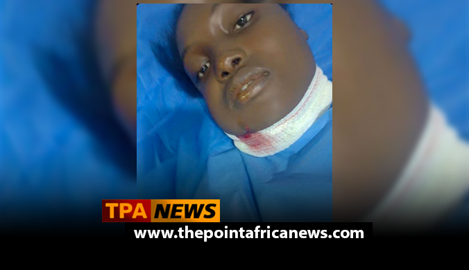 Civilian Injured During Police Anti-Robbery Operation in Monrovia